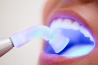 Отбеливание зубов лазером в Германии